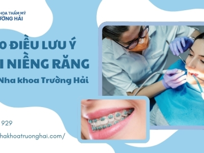 10 Điều cần lưu ý gì trước và sau khi niềng răng?